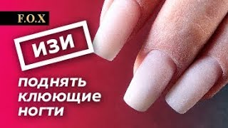 Поднимаем клюющие ногти после ДРУГОГО МАСТЕРА. Самый легкий способ от Алены Калитки