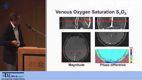 Blood Oxygen Saturation as an Endogenous Dynamic M...