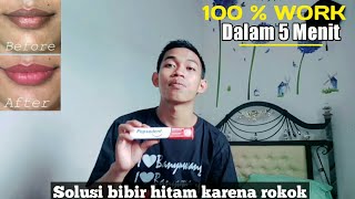 Cara Mengatasi Bibir Hitam Dalam 5 Menit