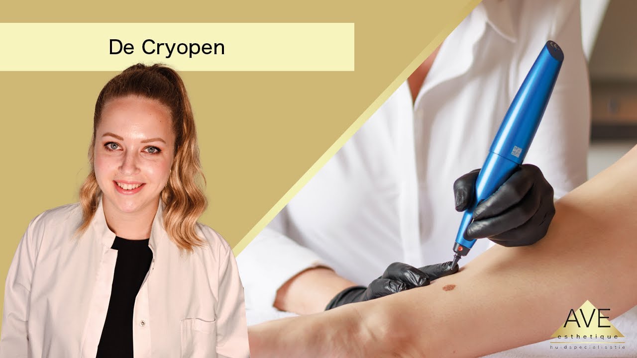 Storende plekjes verwijderen met Cryopen - AVE Huidkliniek