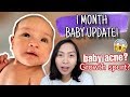 1 MONTH BABY UPDATE | BABY ACNE? GROWTH SPURT? | Philippines