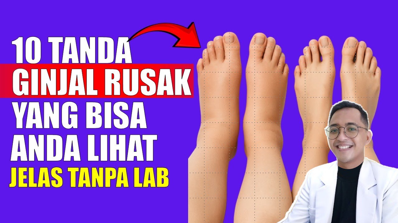 10 Tanda Jelas GINJAL RUSAK yang Bisa Dilihat Langsung!