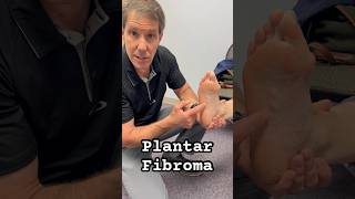 A plantar fibroma is a deposit of fibrous tissue in the medial plantar fascia. #physicaltherapy