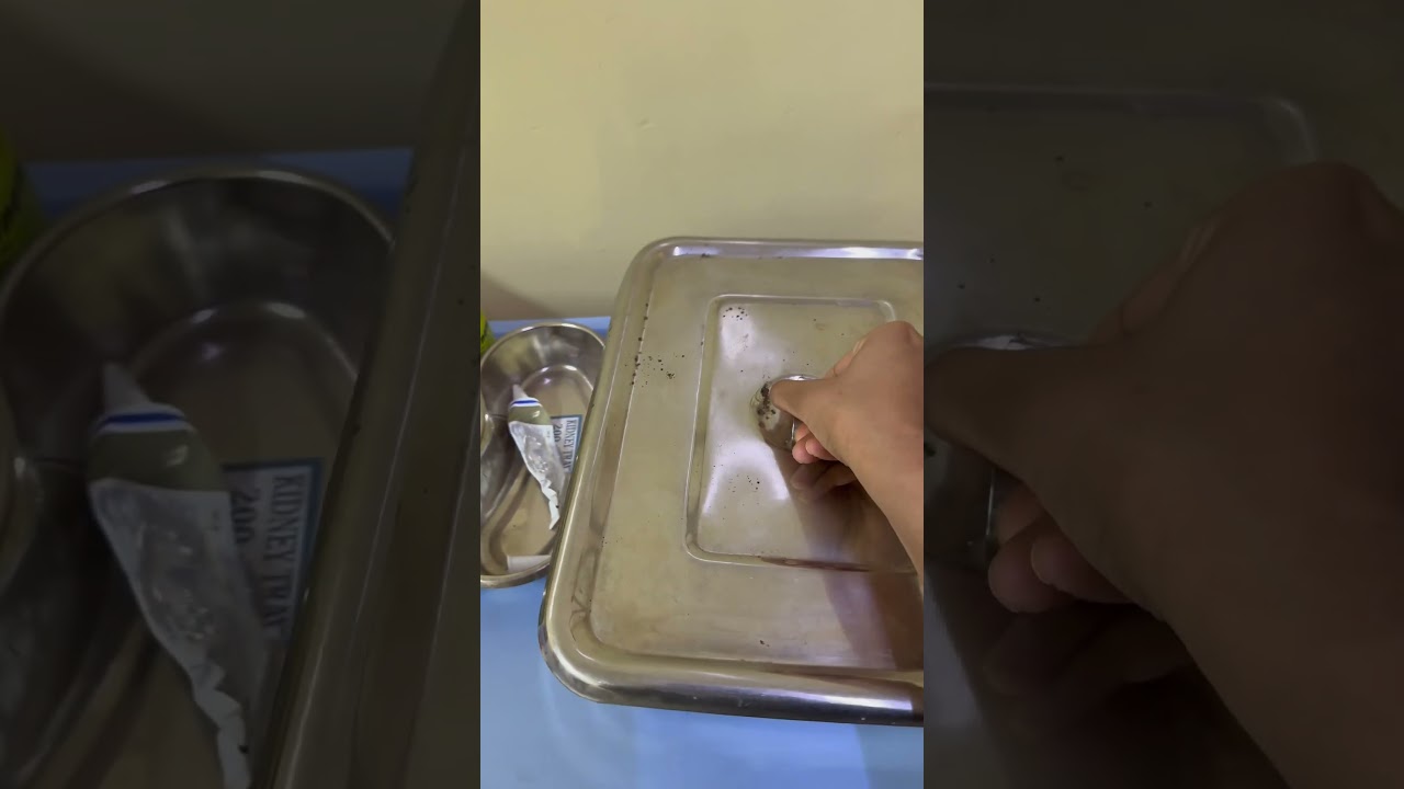 Chattisgarh ravadaniki main reason ide 