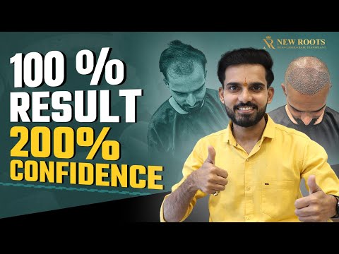 My Hair Transplant Journey 😃 | Cost, Results, and Everything in Between | New Roots Nagpur