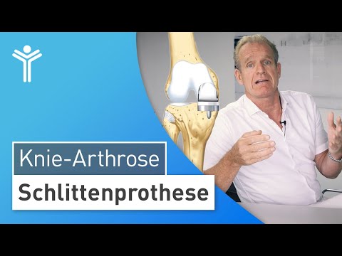 Teilgelenkersatz bei Knie-Arthrose: Schlittenprothese | Künstliches Kniegelenk | Knieprothese