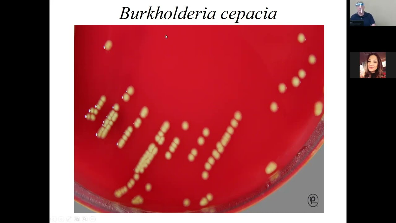 Microbiology | Non-fermenting Gram Negative Rods Review
