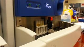 The iris urine analyzer