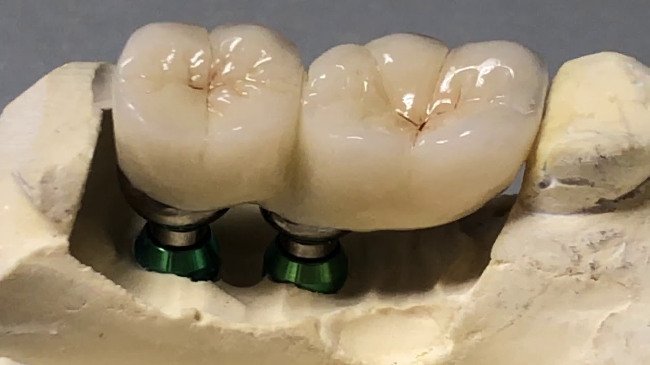 HELL'S KITCHEN DENTAL YouTube