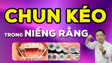 Công Dụng Quan Trọng Của Chun Kéo Trong Niềng Răng