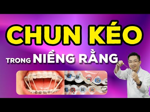Video Công Dụng Quan Trọng Của Chun Kéo Trong Niềng Răng - youtube