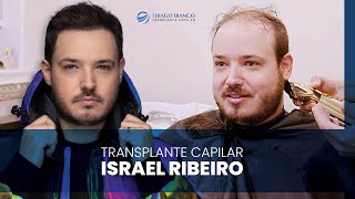 Transplante capilar com Israel Ribeiro