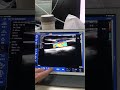 DEMO D33i 3 in 1 wireless ultrasound probes incomparable in imaging and price.