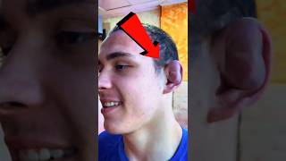 Dlaczego Uszy Tego Mężczyzny Wyglądają W Ten Sposób?