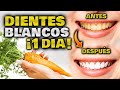 DIENTES BLANCOS y PERFECTOS en 2 MINUTOS!! Cómo Blanquear los Dientes RÁPIDO | REMEDIO CASERO FACIL