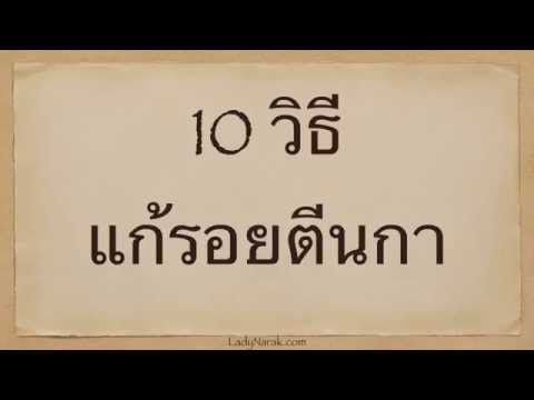10 วิธีแก้รอยตีนกา
