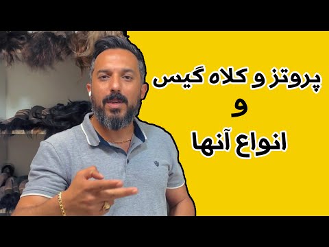 انواع پروتزهای مو انواع کلاه گیس