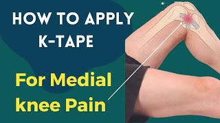 How to treat Knee Pain - Medial Collateral Ligament (MCL) - Kinesiology taping