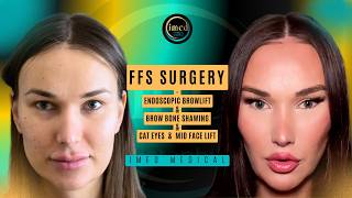 FFS Transformation in Istanbul | Endoscopic Mid Facelift, Temporal Lift &amp; Jawline Sculpting