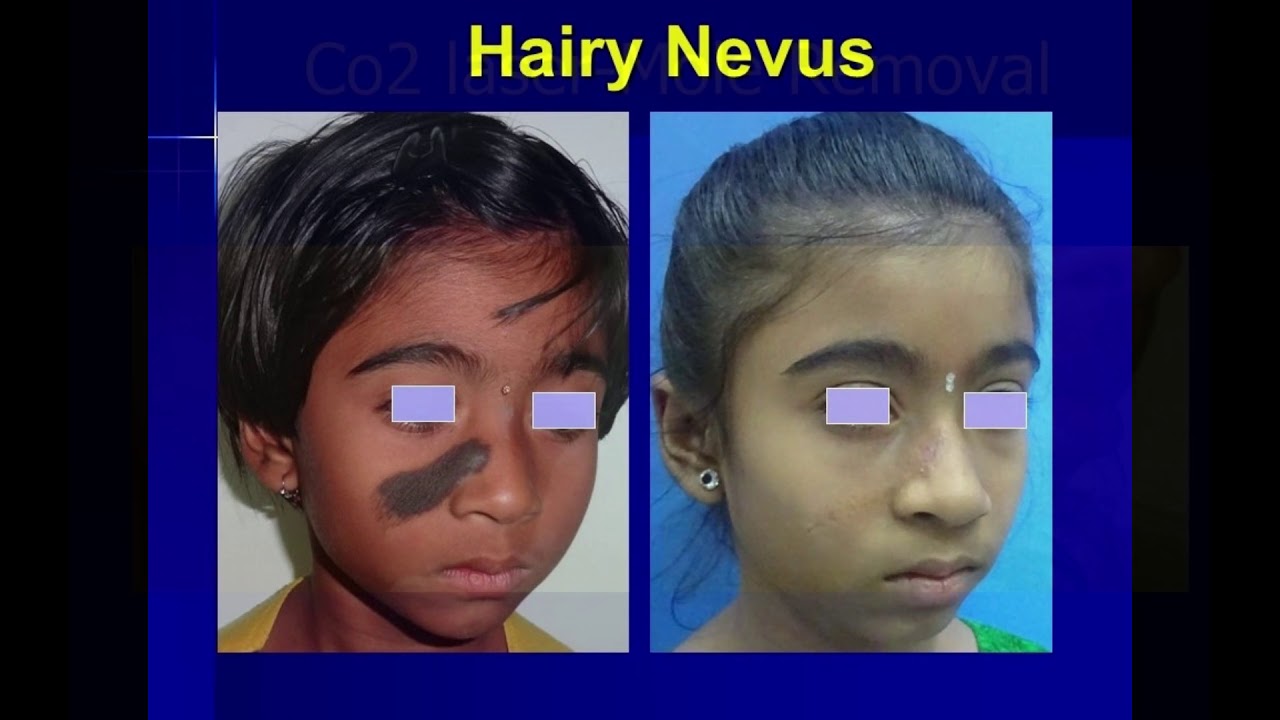 Plastic surgery for Birth defects at Bembde Cosmetic Surgery Hospital