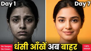 How to Fix Sunken Eyes Naturally in Just 7 Days | Eyecare Expert Rakesh screenshot 5