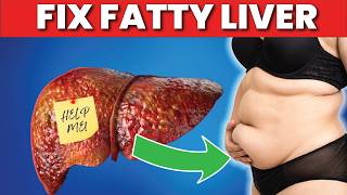 Strictly Avoid these 5 Foods if you have Fatty Liver