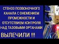 стеноз спинномозгового канала с онемением промежности и расстройством тазовых органов