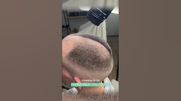Thumbnail of Thinning Hair Get Thicker, Fuller Hair in SECONDS! Hair Building Fibers Review Caboki & More