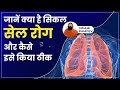       sickle cell disease       swami ramdev