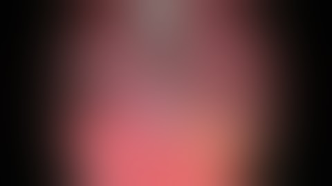 Dr Emad Tahir ; lap treatment of perforated  acute appendicitis