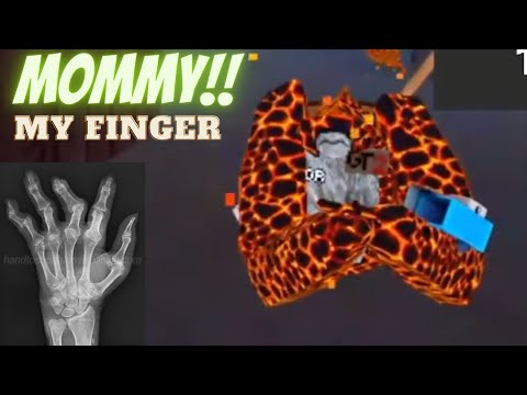 Kid breaks his finger in Gorilla Tag (hilarious)