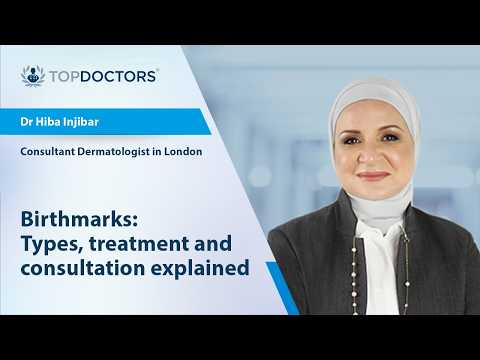Birthmarks: Types, treatment and consultation explained