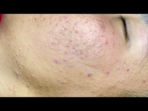 Satisfying video with Chung Vo Spa | 229