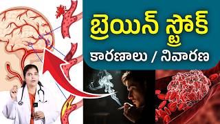 “Stop Brain Stroke NOW! 🧠 Diabetes Warning Signs You Must Know”| Dr.Deepthi kareti| #shorts