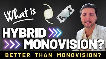 Is Hybrid Monovision better than traditional Monovision? | Patient Interview