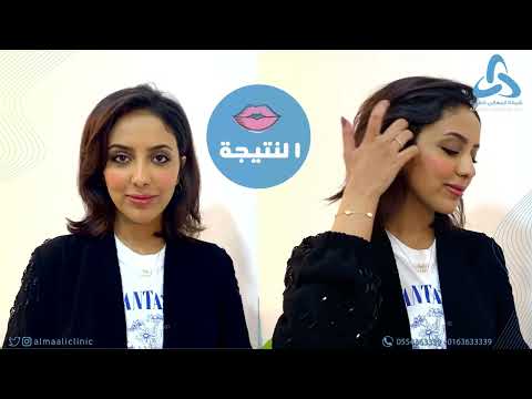 ماهي طريقة حقن الفيلر مع د نورة القلا