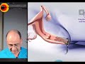 يعني ايه خربشه الرحم وايه علاقتها بالحقن المجهري