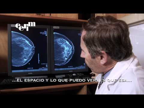 Tomosintesis (Mamografía 3D) -  CERIM