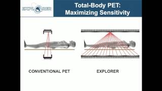 Simon Cherry Explorer -- Changing The Molecular Imaging Paradigm With Total-Body Petct