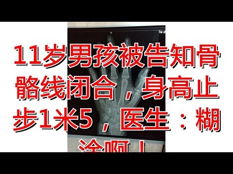11岁男孩被告知骨骼线闭合，身高止步1米5，医生：糊涂啊！