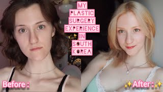 My Experience having Two Jaw & Facial Contouring Surgery in Korea with MACS OMFS & Docfinderkorea