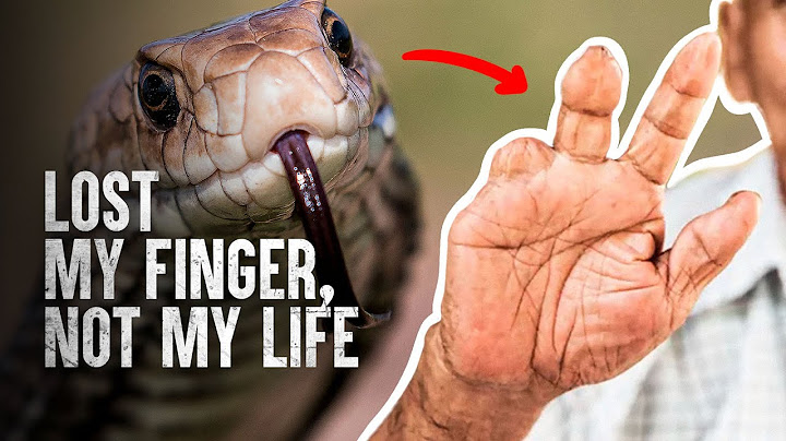 How to Survive The Most Dangerous Snake Bites - Part 2