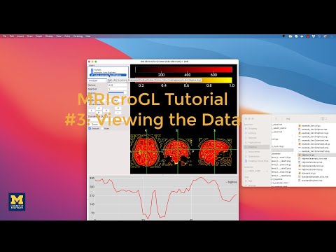 MRIcroGL Tutorial #3: Viewing Data