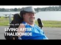 Living After Thalidomide
