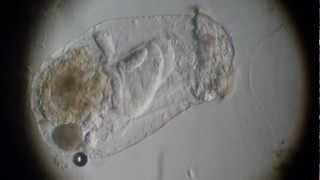 Asplanchna in 2/3 oblique lighting