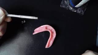 Locator cap removal technique