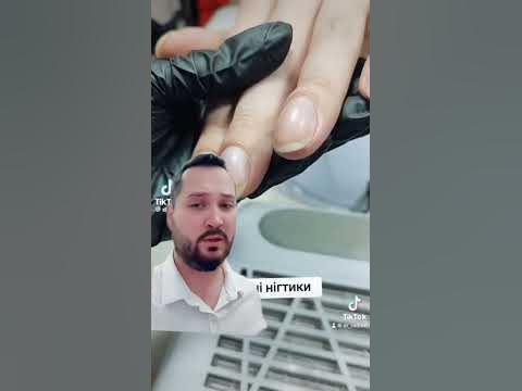Симптом барабанных палочек - YouTube