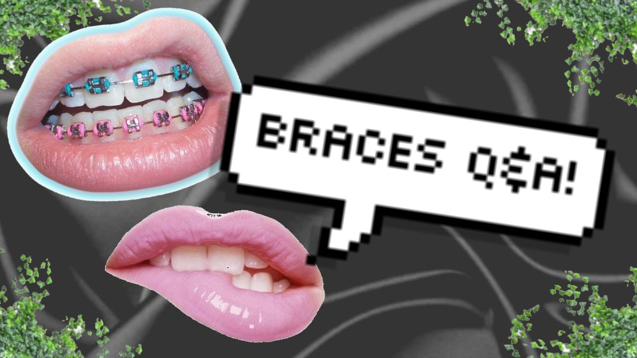 BRACES Q&A! YouTube