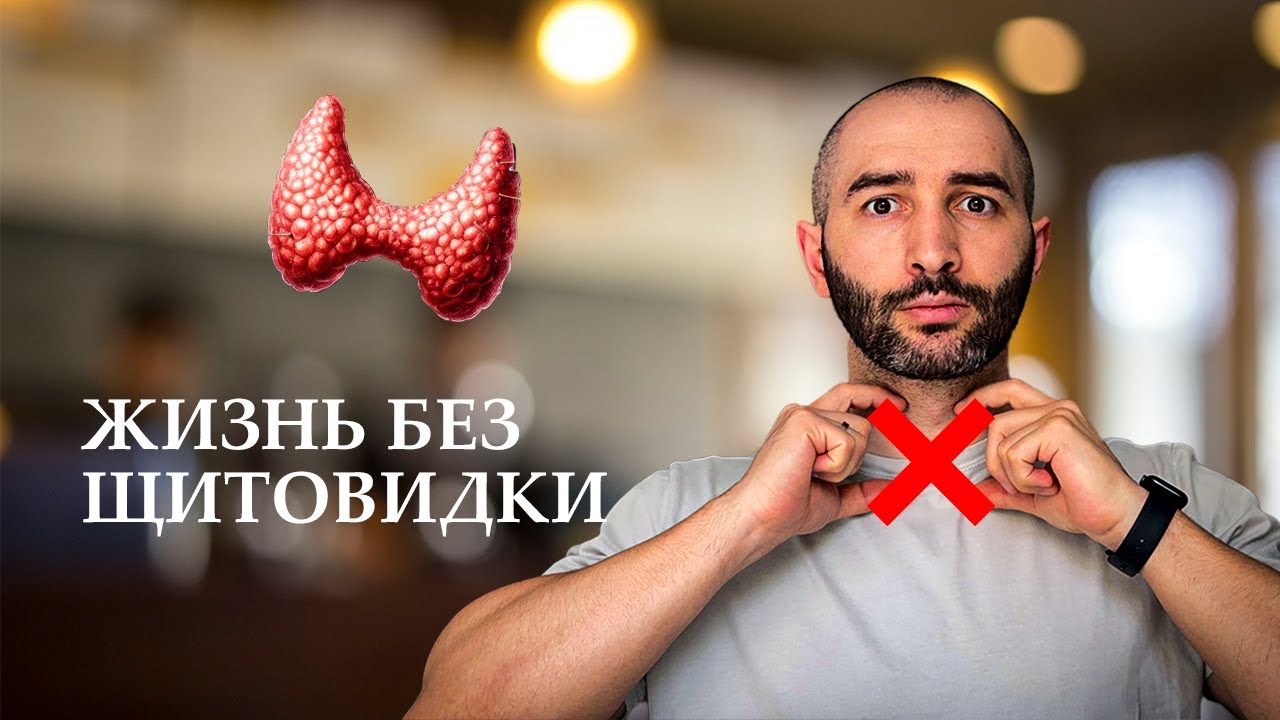 Жизнь ПОСЛЕ УДАЛЕНИЯ щитовидки. Советы врача