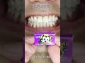 Satisfying Chewing ASMR #Compilation #ASMR #DoctorTristanPeh